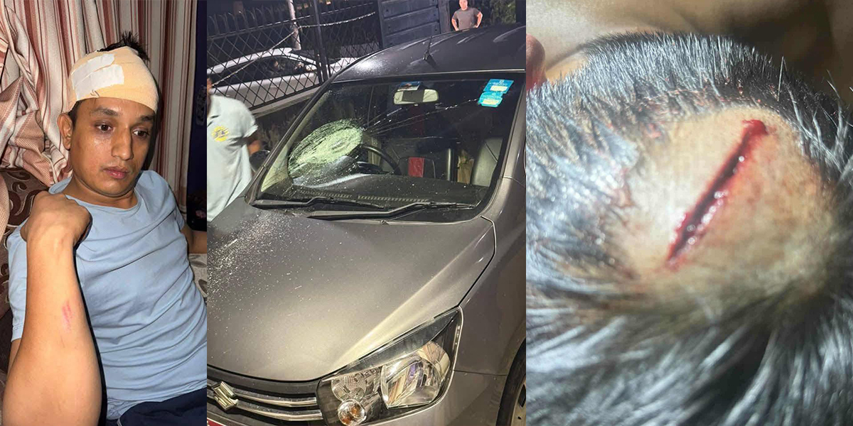 बदन भण्डारीमाथिको आक्रमण राजनीति इस्युमा गरियो, दोषीलाई कारबाही गरियोस् : रास्वपा