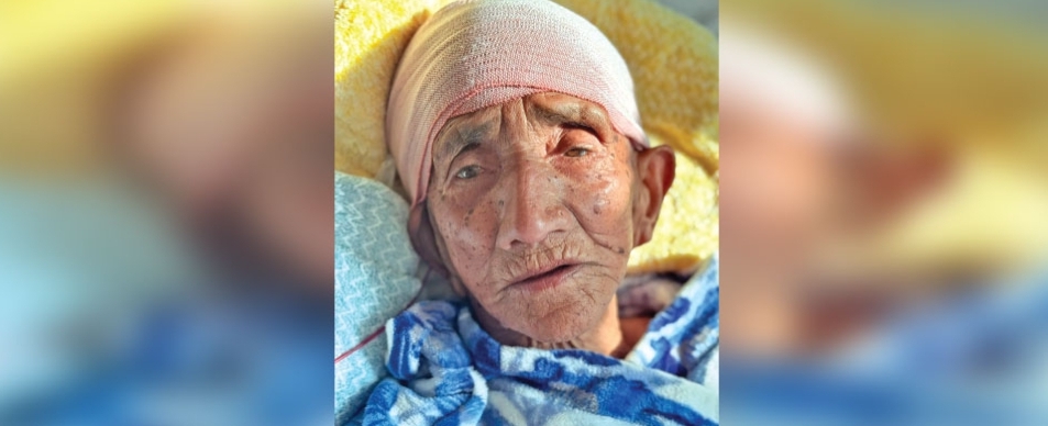 वीर अस्पतालमा १०३ वर्षीया वृद्धाको सफल न्युरो शल्यक्रिया